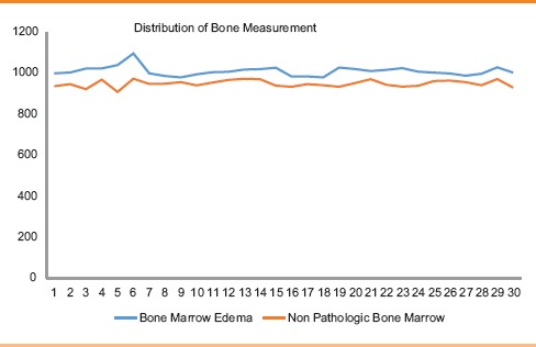 Dual energy CT and research of the bone marrow edema: Comparison with MRI imaging.